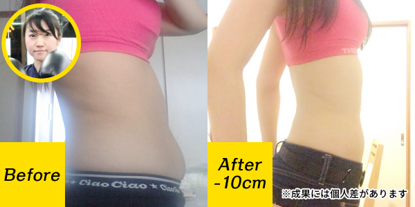 Before-After