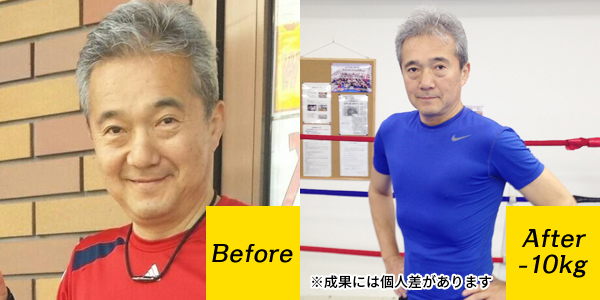 Before-After